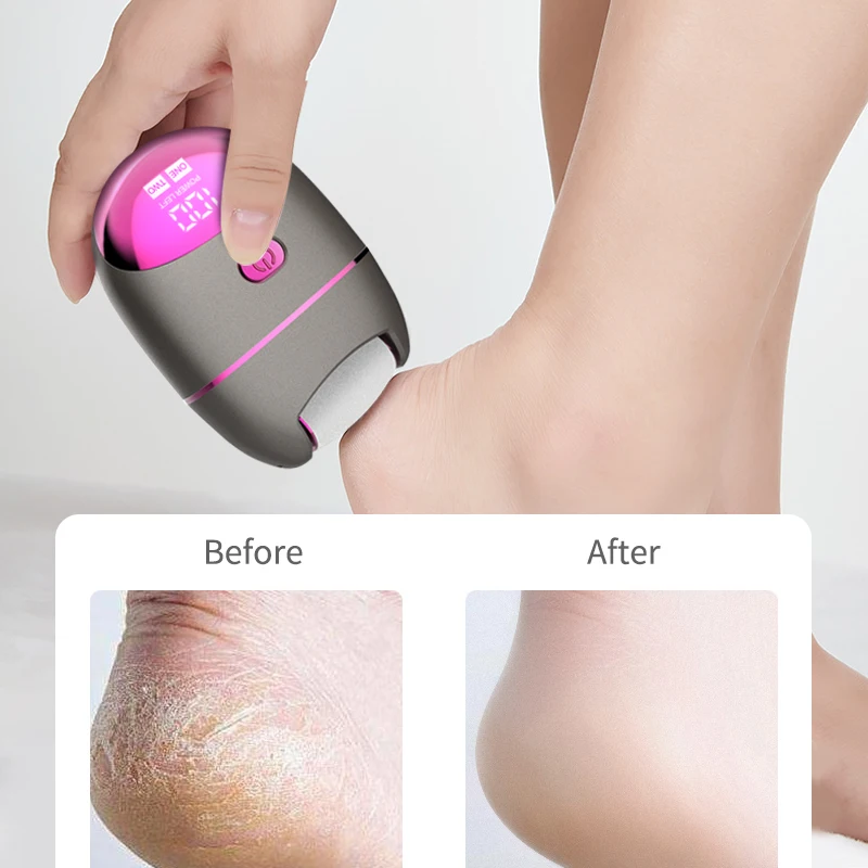 Portable Electric Foot Pedicure Tool Wireless Foot Grinder 2 Gears Waterproof USB Charging Callus Dead Skin Removal Foot Care