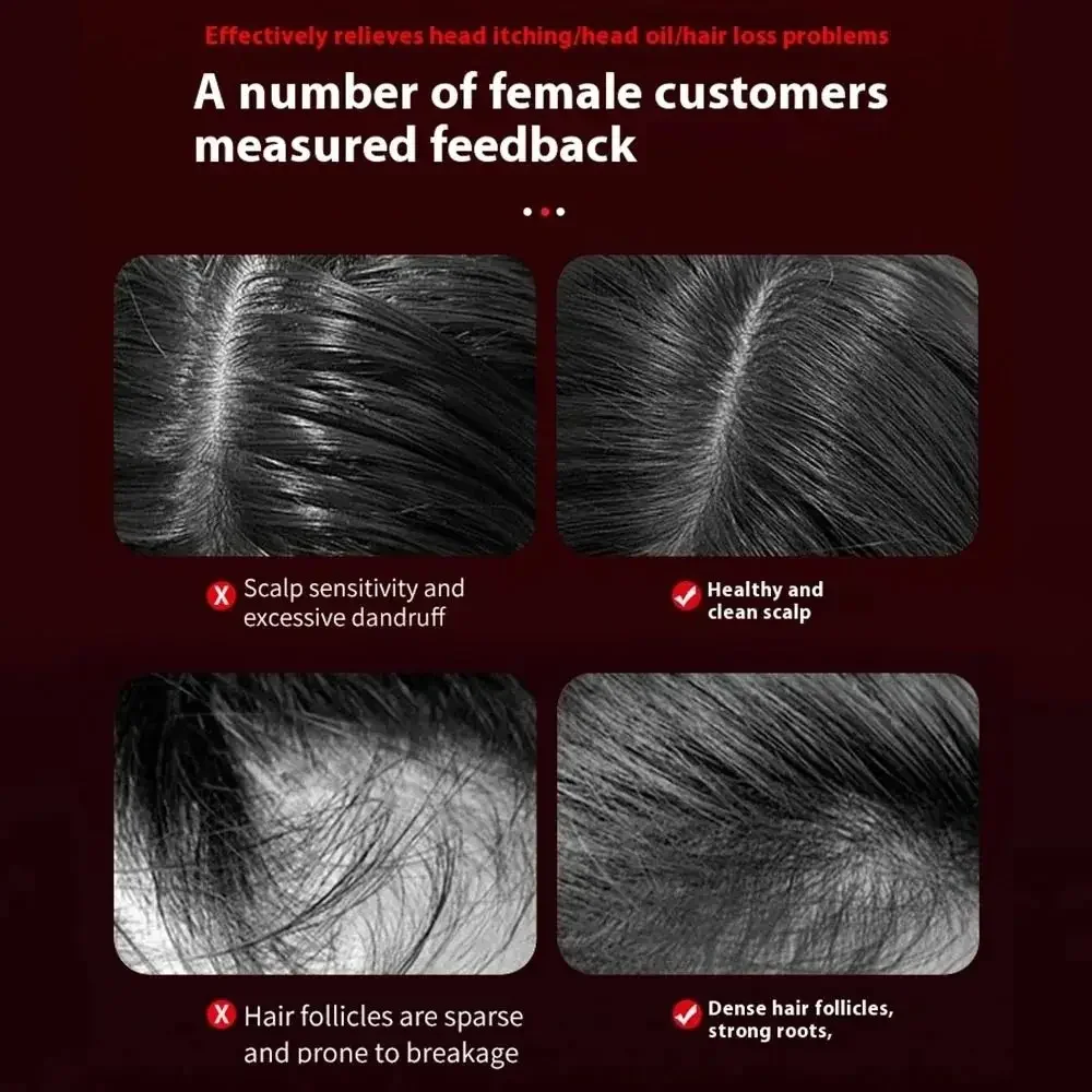 新しいヘアケア頭皮マッサージコーム抗脱毛赤外線ライトヘッドマッサージャータイプ C ヘアオイルアプリケーターヘアコームヘアツール