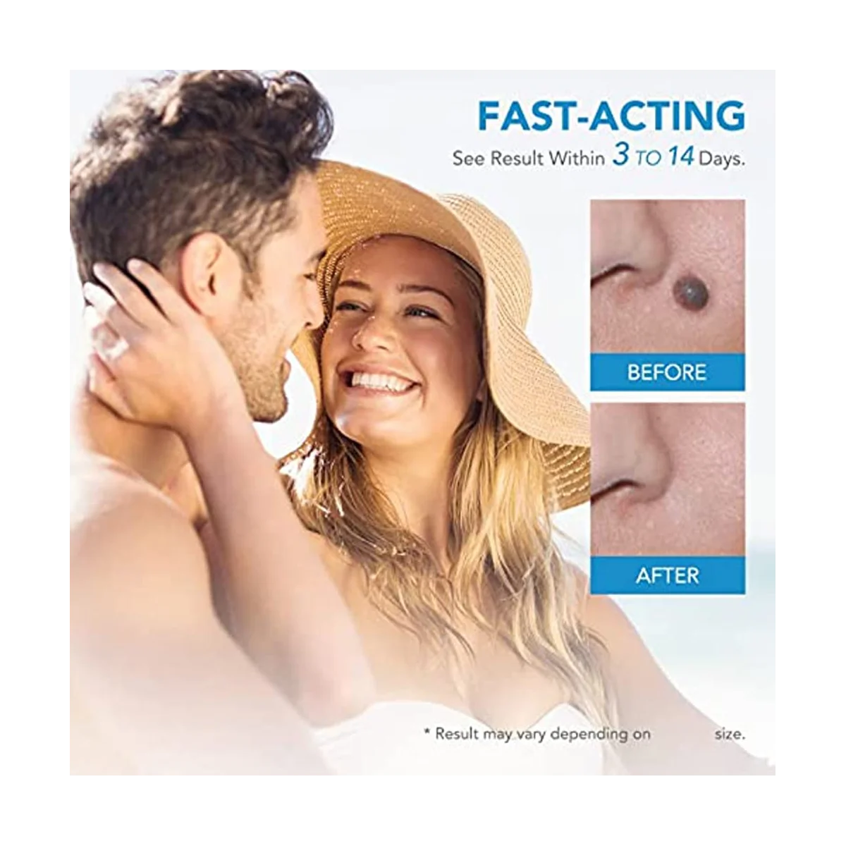 Indolor Auto Mole Verruga Remoção Kit, Cuidados Com A Pele, Corpo Verruga, Dot Tratamentos Removedor, Ferramentas De Limpeza, 2 em 1