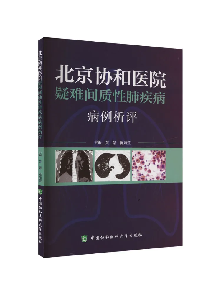 

Книга-Уинзац, комментарий на случайх аллергических лечения легких заболеваний в Пекинском Союзе, медицинской студенческой больницы