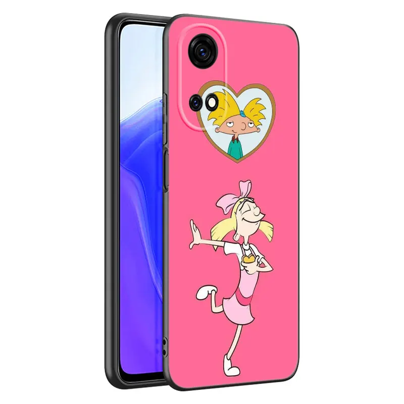 Hey Arnold Hot Black Phone Case For Honor 70 90 200 Magic 4 5 6 Lite X5 X6A Plus X6 X6S X7A X7B X8 X8A X8B X9 4G X9A X9B 5G