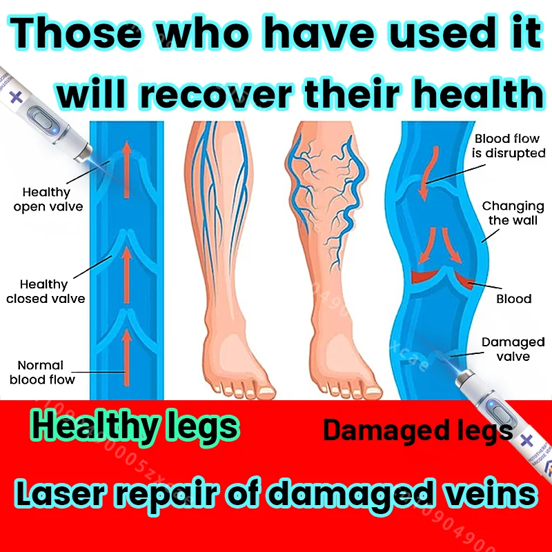 

Company mission: To fundamentally solve varicose veins with the power of technology