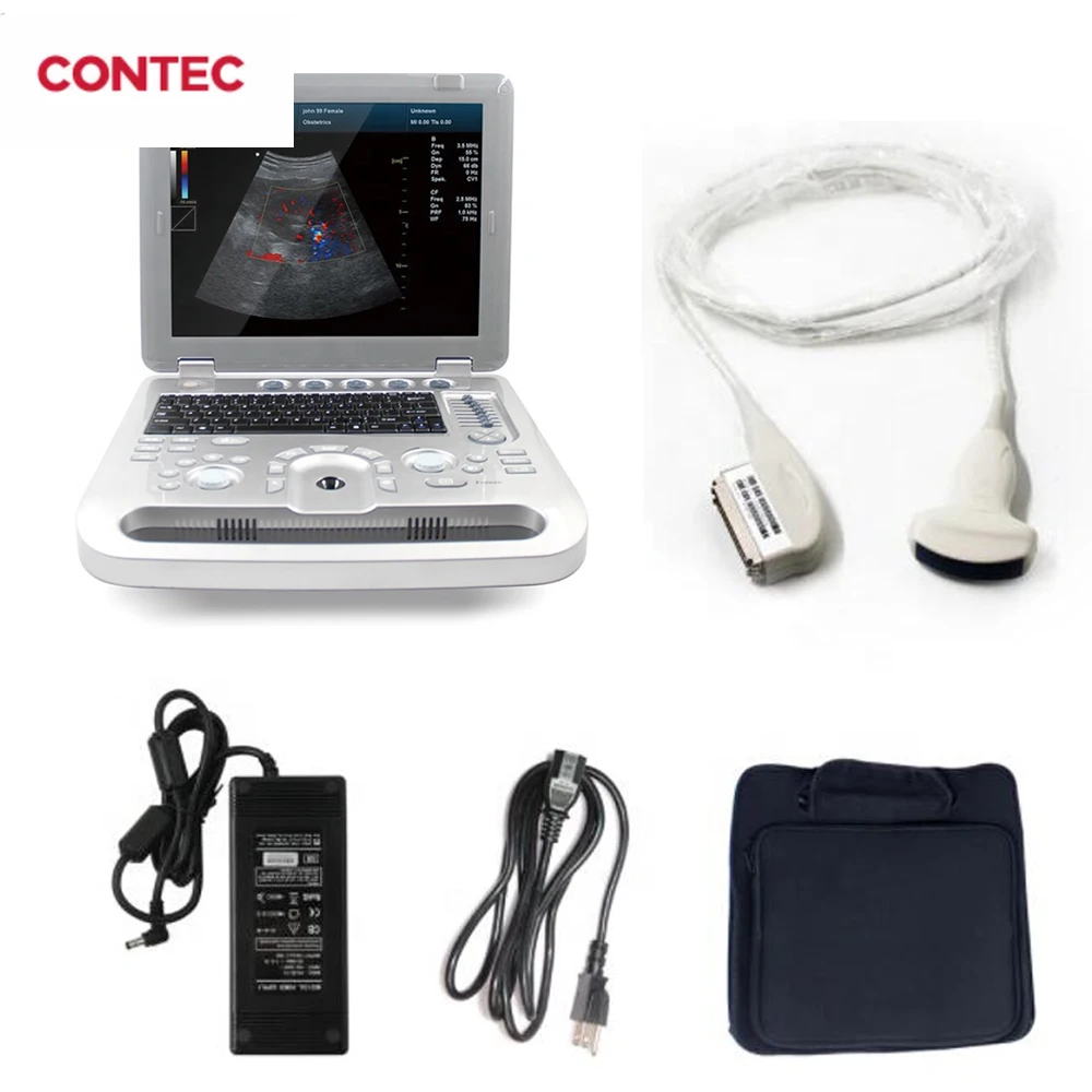 CONTEC CMS1700A Цветной доплеровский ультразвуковой диагностический ультразвуковой сканер CF USG 3,5 МГц/6,5 МГц/12,5 МГц