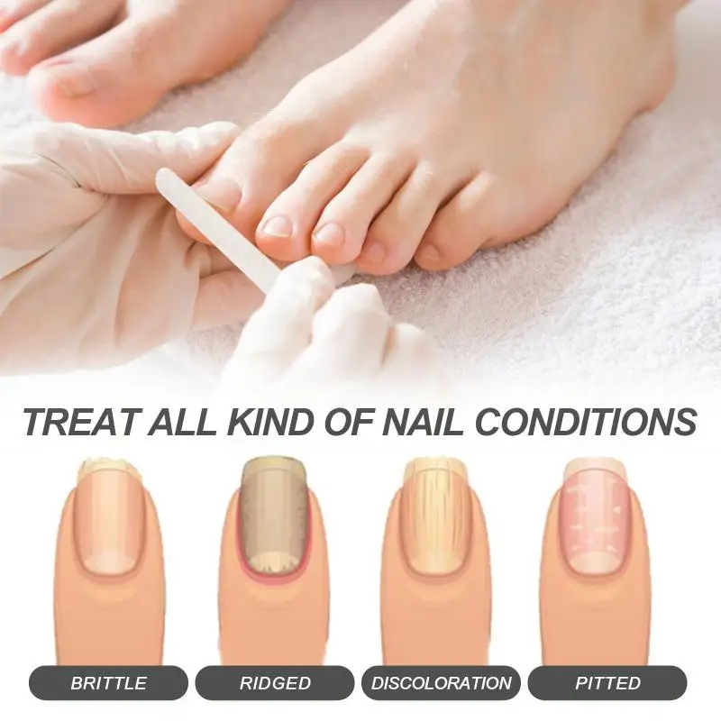 OceanAura nail care  for repairing rotten nails moisturizing brightening nails strengthening and maintaining