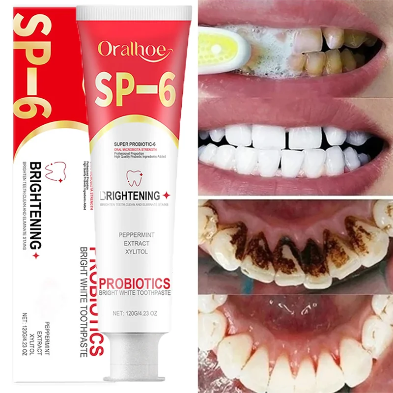 Pasta de dientes probiótica SP-6 para blanquear los dientes, elimina manchas, gestión del cuidado bucal, aliento fresco con sacarin DE SODIO, lactobacilos