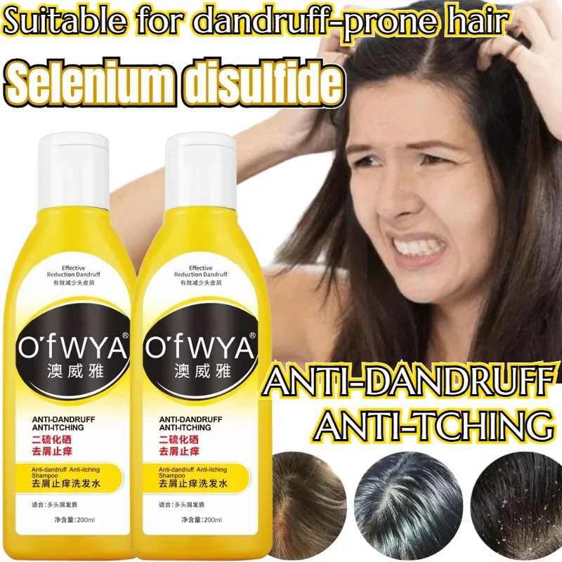 Get Rid of Dandruff and Relieve Itching Shampoo 200ml Refreshing Oil Control Deep Cleans Hair Follicles To Solve Scalp Problems