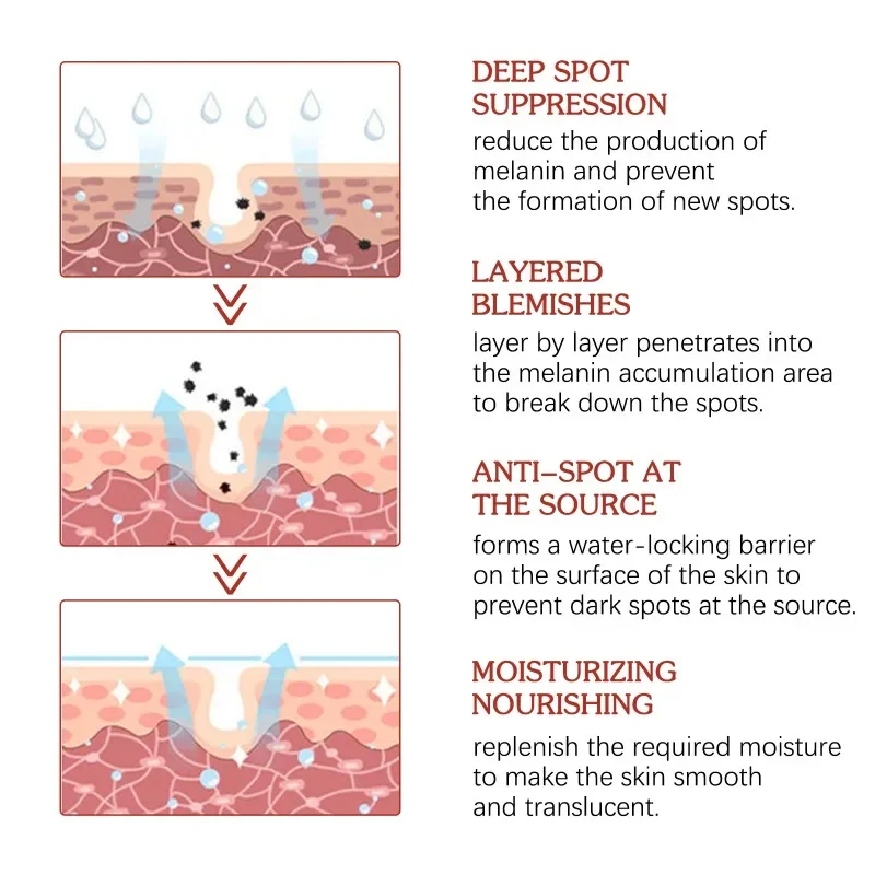 ครีมช่วยให้ผิวขาวช่วยขจัดจุดด่างดำช่วยลดเลือนเม็ดสีเมลานินให้ความชุ่มชื้นซ่อมแซมผิวให้กระจ่างใส