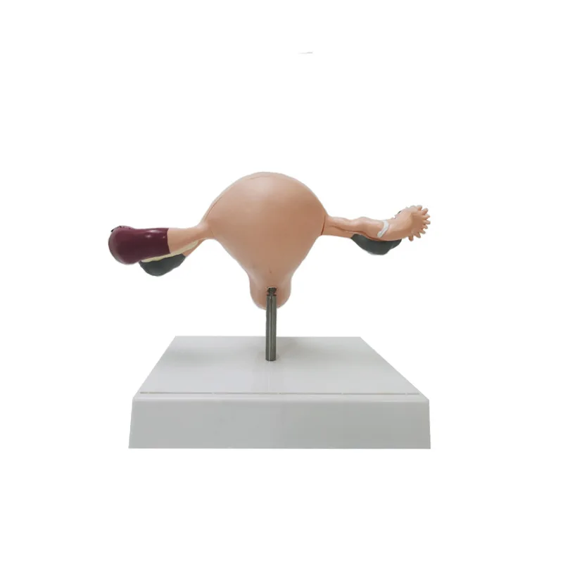 Medical Human Pathological Uterine And Ovarian Anatomical Model Gynecological Display Medical Teaching Supplies