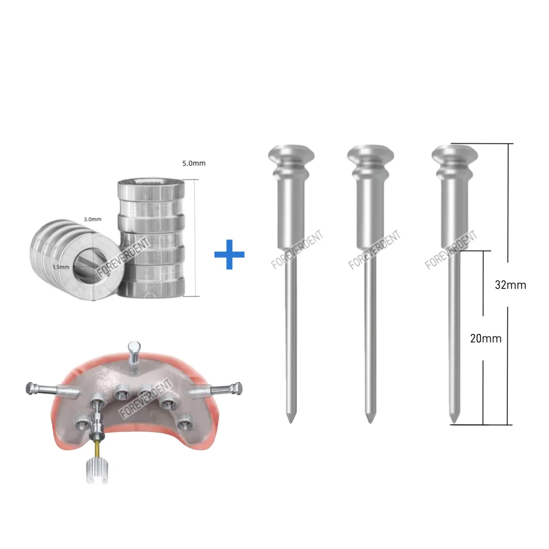 

Якорный штифт для зубного имплантата, направляющая для гвоздей, цифровая челюстная дрель, универсальные рукава 3x1,5x5 мм
