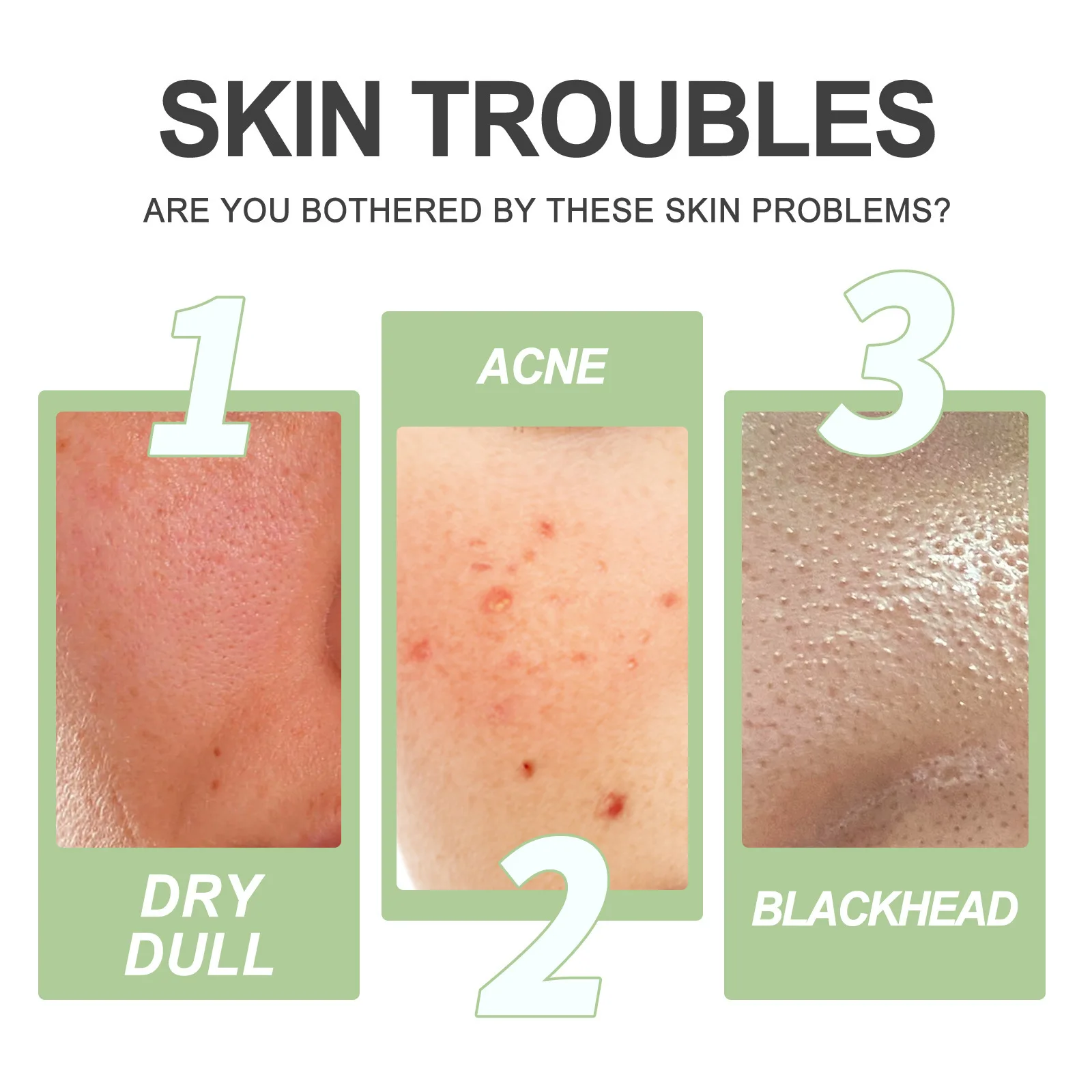 Fruit Acid Exfoliating Deeply Cleanses Pores Blackheads Acne Brightens Skin Radiant Complexion Moisturizing Brightening