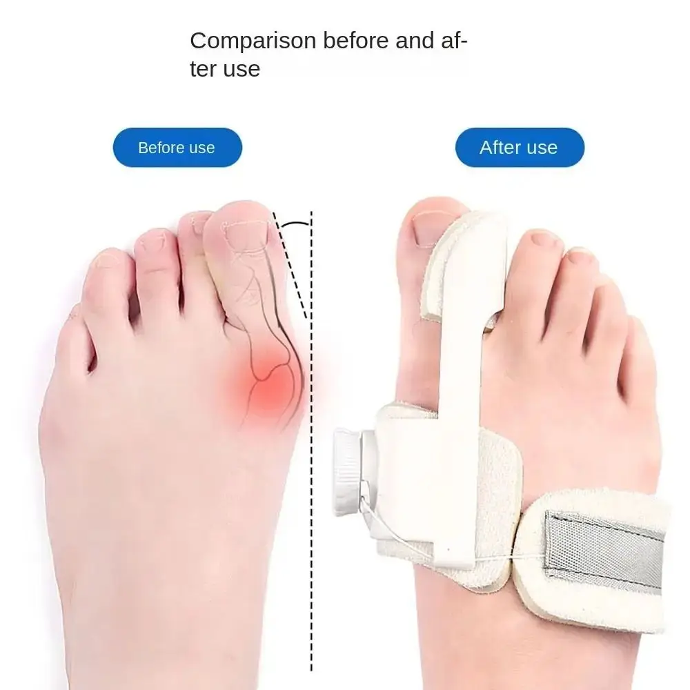 Adjustable Bunion Valgus Corrector Rotatable Joint Support Big Toe Straightener Toe Valgus Dislocation Fracture