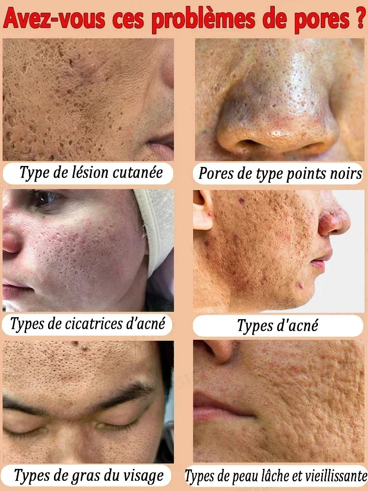 Suero reductor de poros, crema de ácido lactobiónico, reafirmante facial, cuidado de la piel coreano