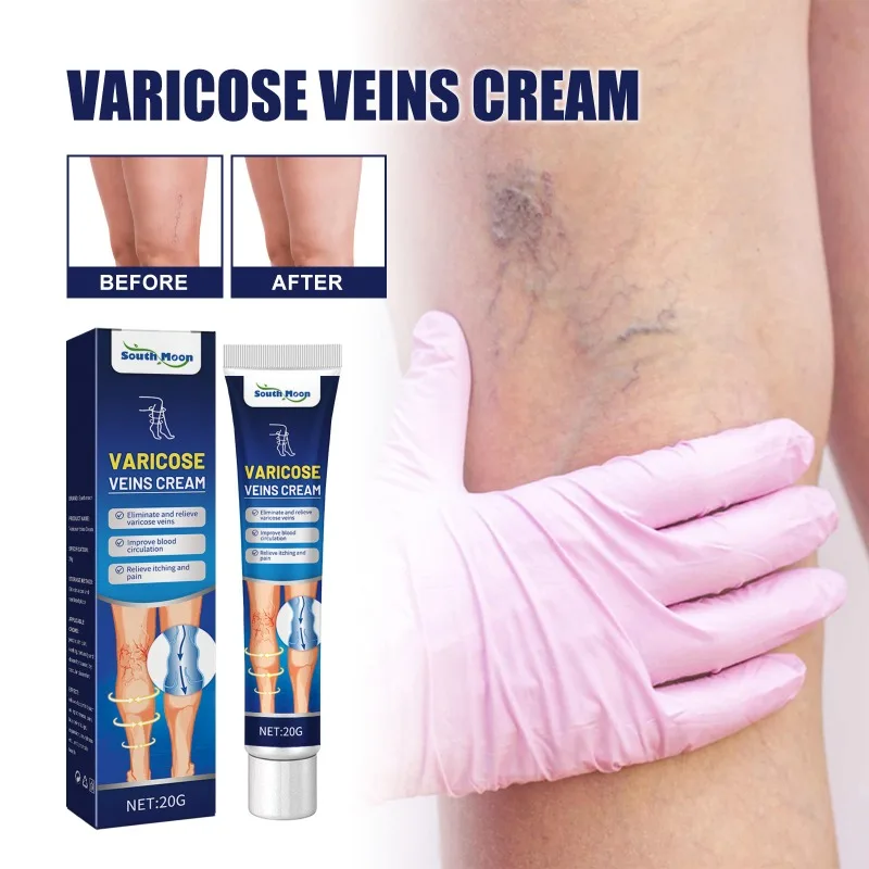 20g Venous Massage Varicose Cream Relieves Leg Vascular Protrusion Varicose Veins Earthworm Leg Repair Care Cream