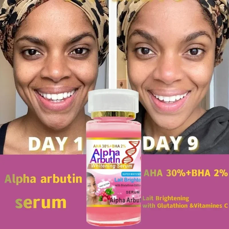 Alpha Arbutin Serum Keeps Skin Smooth and Soft Whitening Hydrating Even Skin Tone Face Skincare Serum for Dark Skin Beauty Care