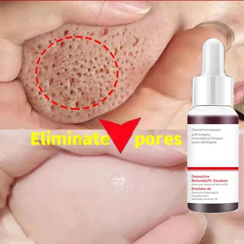 

26 Facial Pore Minimizing Serum for Repairing and Tightening Face; Beauty Skin Care Essence Pore Smoothing