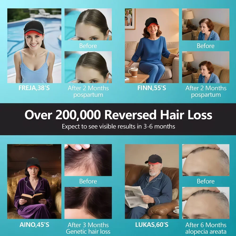 

Лазерное устройство для роста волос Лазерная шапочка для роста волос, восстановление волос 650 нм LLLT Cap Лечение против выпадения волос