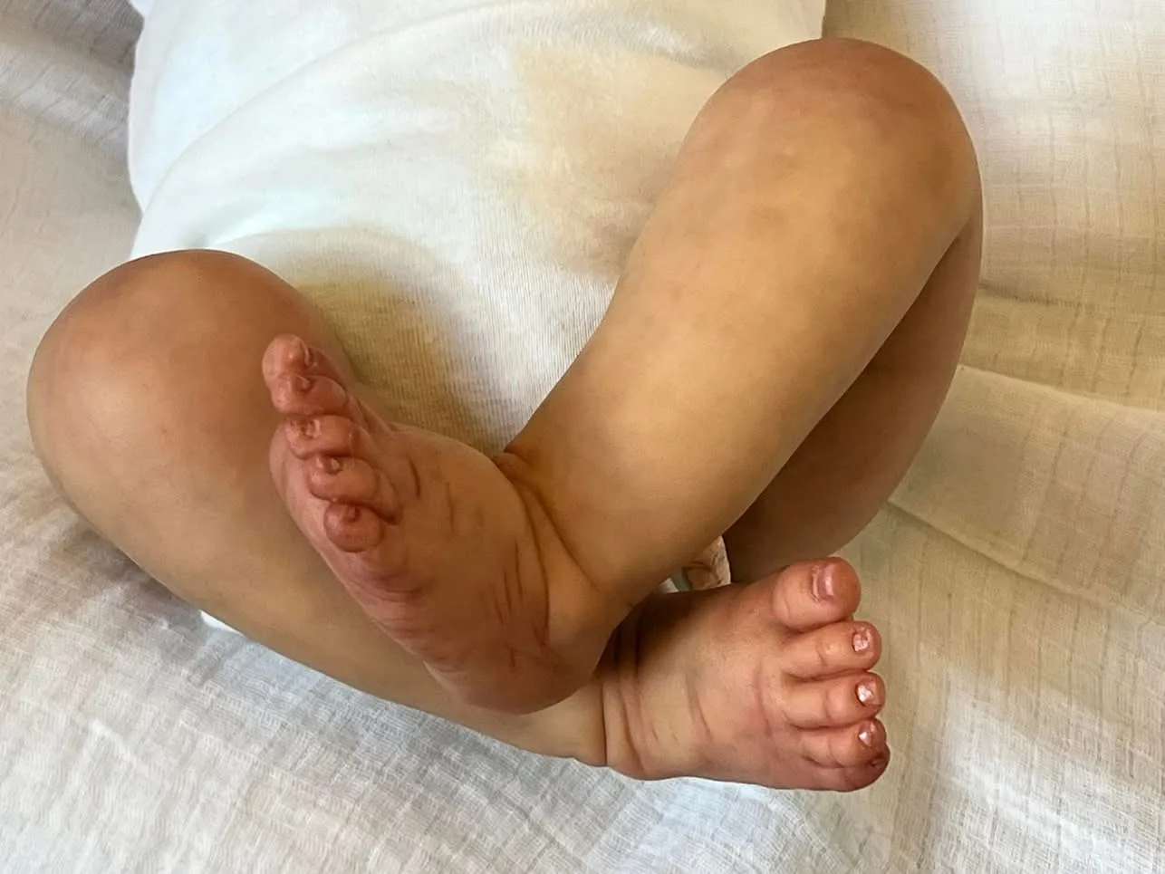 NPK 18 pouces Erica nouveau-né bébé poupée corps doux toucher réaliste Reborn câlin plusieurs couches 3D peau peinture