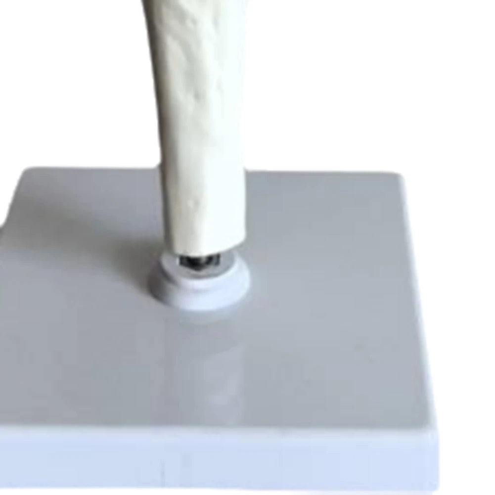 

ABIY-Knee Joint Model Simulation Replacement Surgery Meniscus Ligament Cartilages Surgery Model,Artificial Knee Joint