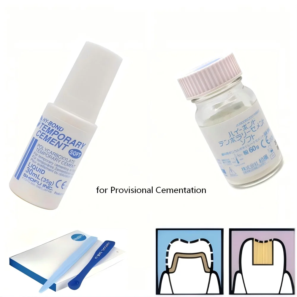 

Стоматологический цемент Shofu для временных коронок и мостов: безэвгеноловый, легкоудаляемый, для временной цементации