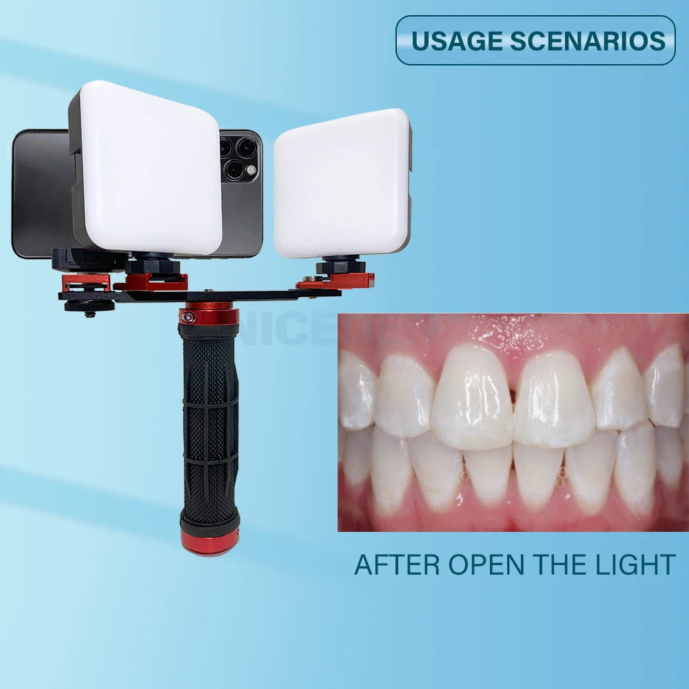 Thumbnail 2 - #8 Best Rated Oral Lamps to Buy in 2026