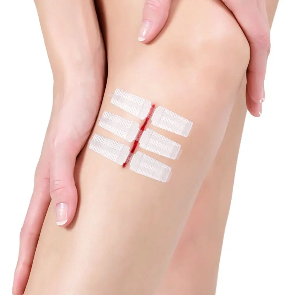 First Aid Zip Sutures Bandaids Adhesive Wound Care Without Stitches Emergency Wound Closures Emergency Laceration Repair