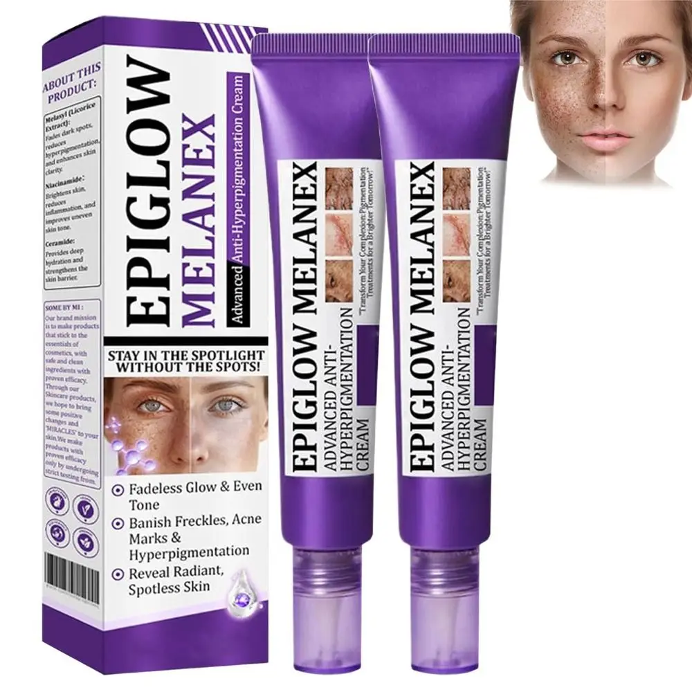 Diepe Reiniging Anti Hyperpigmentatie Crème Donkere Vlekken Remover Verhelderende Behandeling Gezichtscrème 20g Rimpel Remover Gezichtscrème