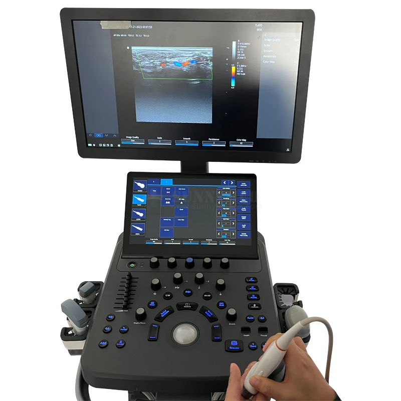 SYA-D40 نظام عربة الموجات فوق الصوتية شاشة لمس ثلاثية الأبعاد/4D