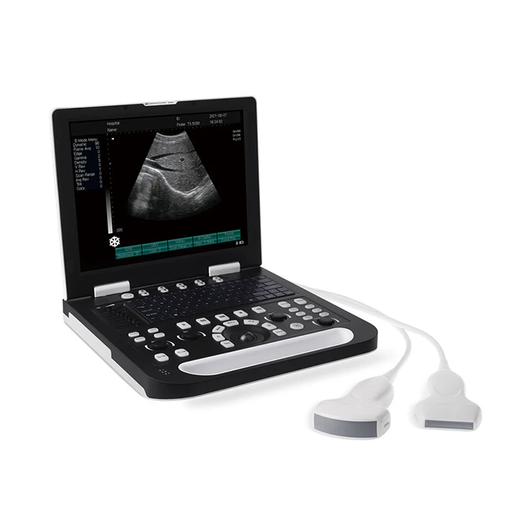 RS-N50(VET) veterinary ultrasound equipment portable Black wireless veterinary ultrasound scanner pet color ultrasound