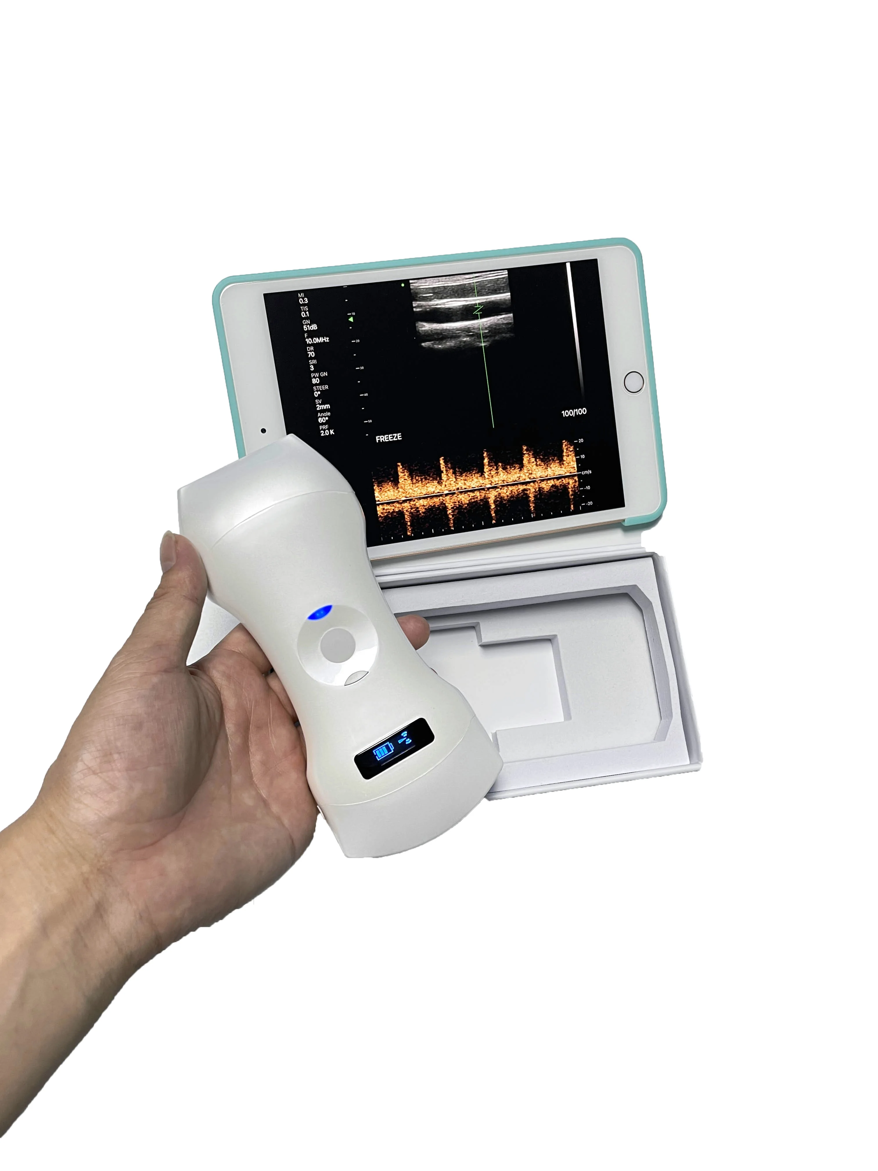 High Quality 192 element Wireless Usb Ultrasound Probe Ultrasound Machine Cheap Price