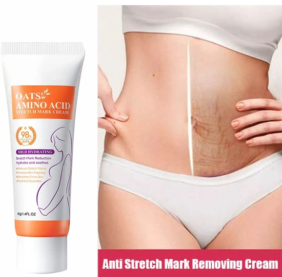 Stretch Mark Removal Cream Permanently Removes Stretch Marks Rejuvenates Skin