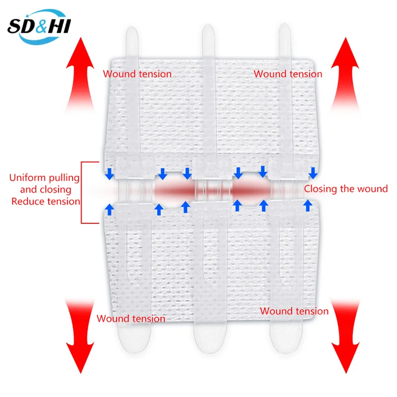 1 Stuks Rits Band Wond Sluiting Patch Rits Pleister Wond Snelle Hechting Buiten Draagbare Hemostatische Patch EHBO-Tool