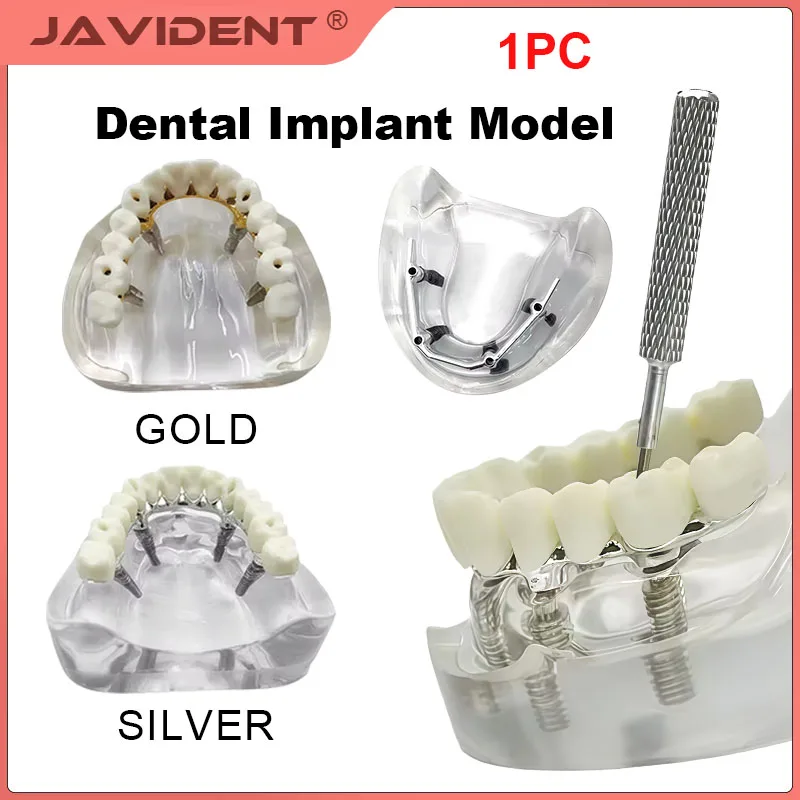 1Pcs High-End Removable Implant Dentures Oral Dental Models Simulated Teaching and Doctor-Patient Communication Dental Materials