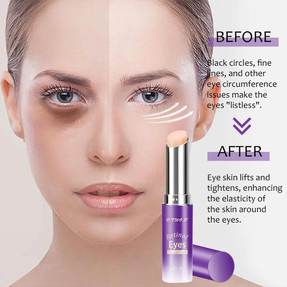 Retinolo Eye Cream Stick occhiaie Eye Bags Remover cura Fine Eye riduce le linee idratante per la pelle Anti-gonfiore Anti-wri S4w5