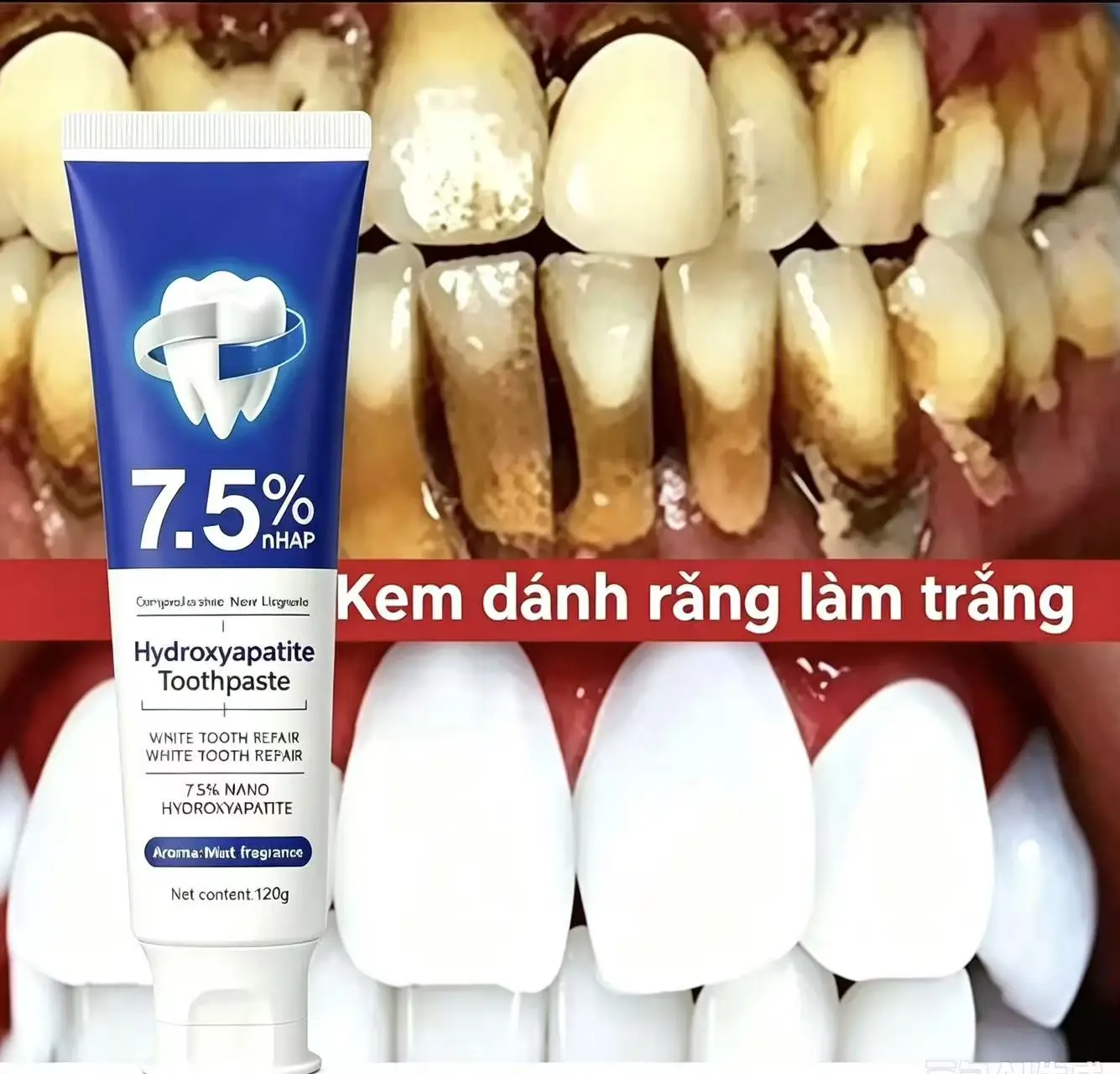 Image of Zahnpasta mit 7,5% Nanohydroxyapatit zur Entfernung von Kaffee- und Teeflecken, zur Verbesserung von Mundgeruch, zur Vorbeugung von Karies und zur Reinigung der Zähne