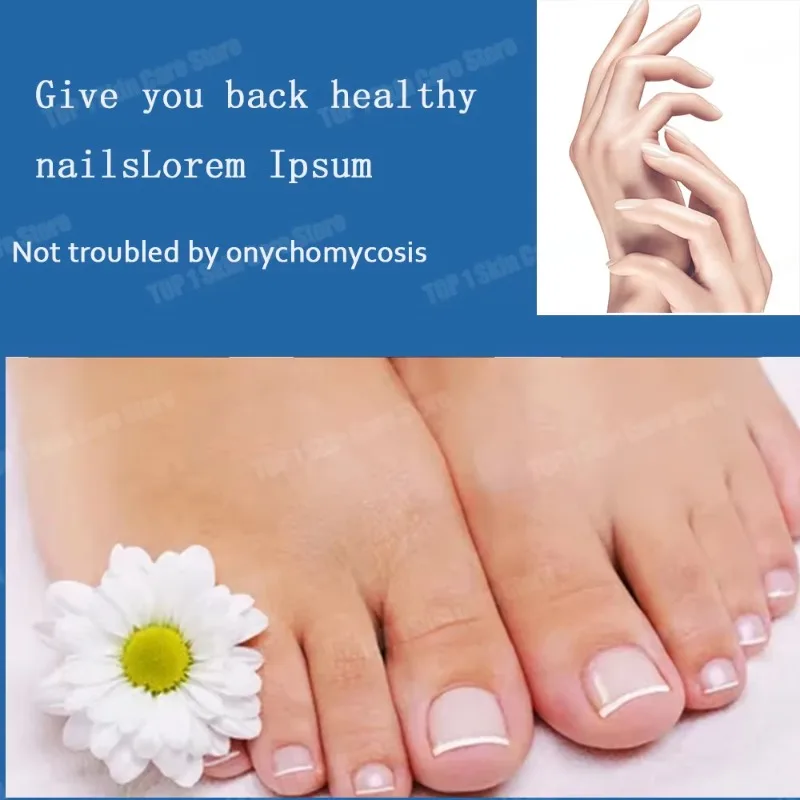 Huile de champignon des ongles, adoucit l'huile de traitement des ongles pour les ongles fragiles et fendus, produit de haute qualité