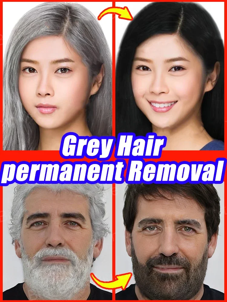 White hair killer, remove gray hair and restore natural hair color in 7 days