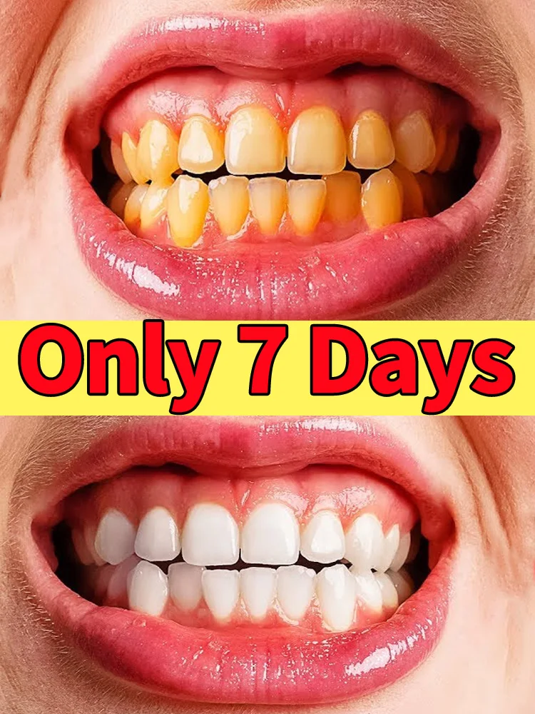 

Tartar removers dissolve tartar and remove stains calculus removal for men women