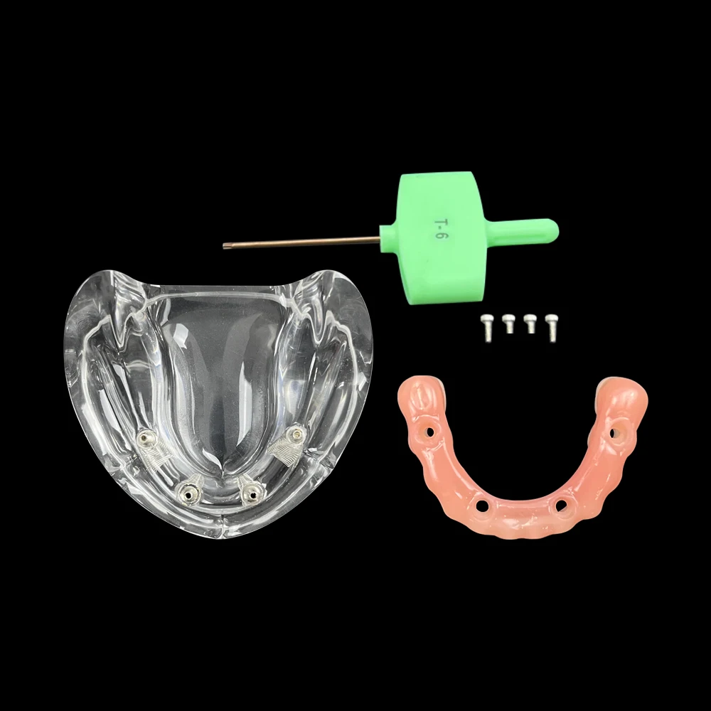 Mandibular Implant Dental Tooth Model With 4 Screws With Removable Denture Repair Bridge Screwdriver Typodont Model Dentist Demo