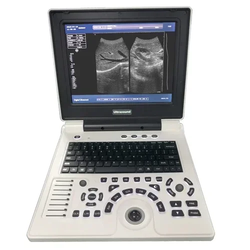 12 Inch LED Screen Black White Animal Notebook Portable Pet Veterinary Ultrasound Scanner USG Machine