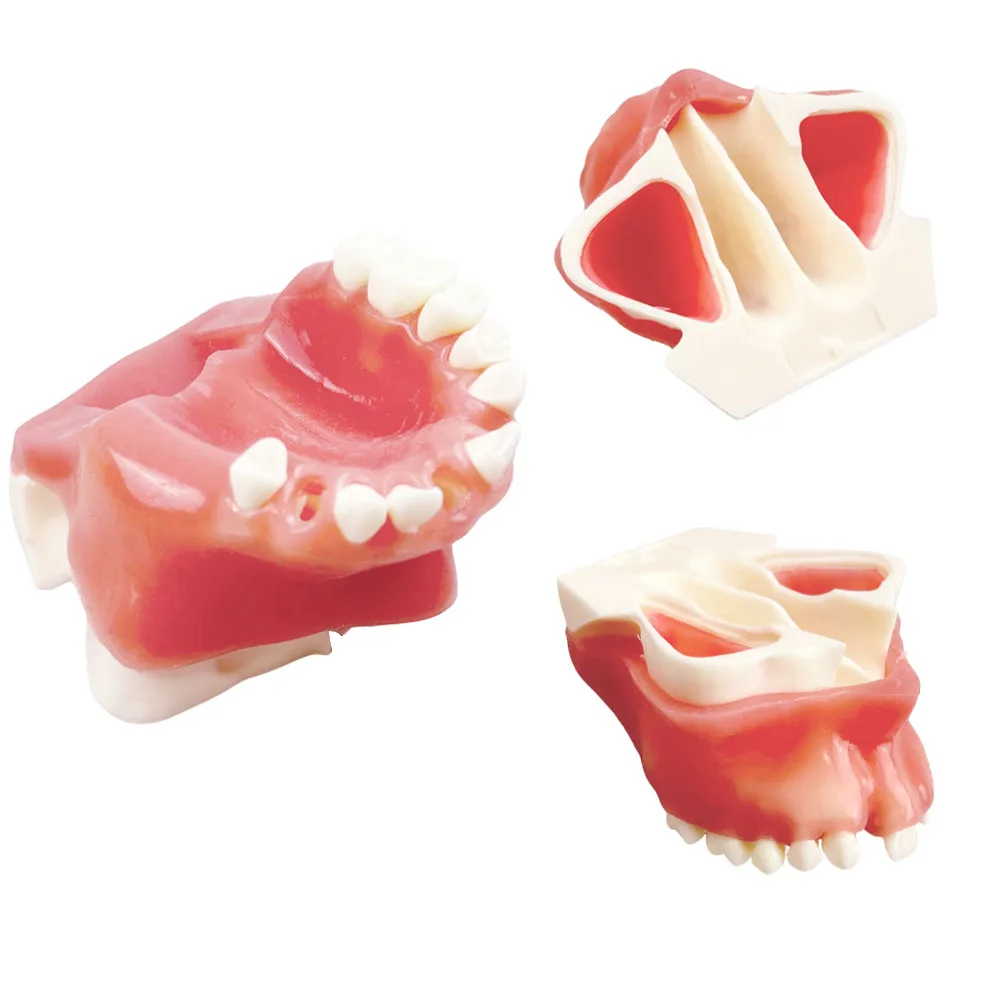 

1pcs Maxillary Sinus Full Mouth Implantation with Missing Teeth Model Student Teaching Practice Model