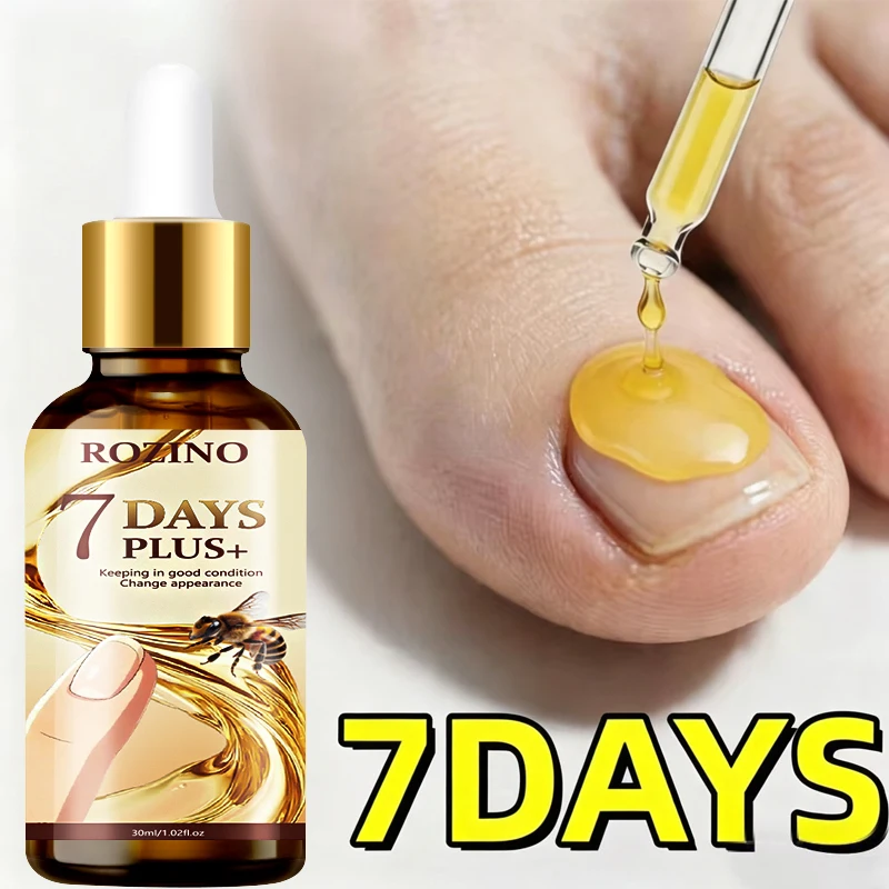 Super Powerful 7-Day Bee Venom Toenail Care Solution Plus+, 7-Day Nail Renewal, Maximum Strength -98% Change in Appearance, Maintains Good Condition, 5 Minutes to Prevent Spread, Renewal, Rapid Hardening, Enhances Nail Shine, Strengthens Nails, 24-Hour Continuous Care for Discolored, Thickened, and Damaged Nails, Prevents Nail Discoloration and Thickening, Promotes Nail Health, Improves Discolored, Damaged, Thickened, and Fragile Nails