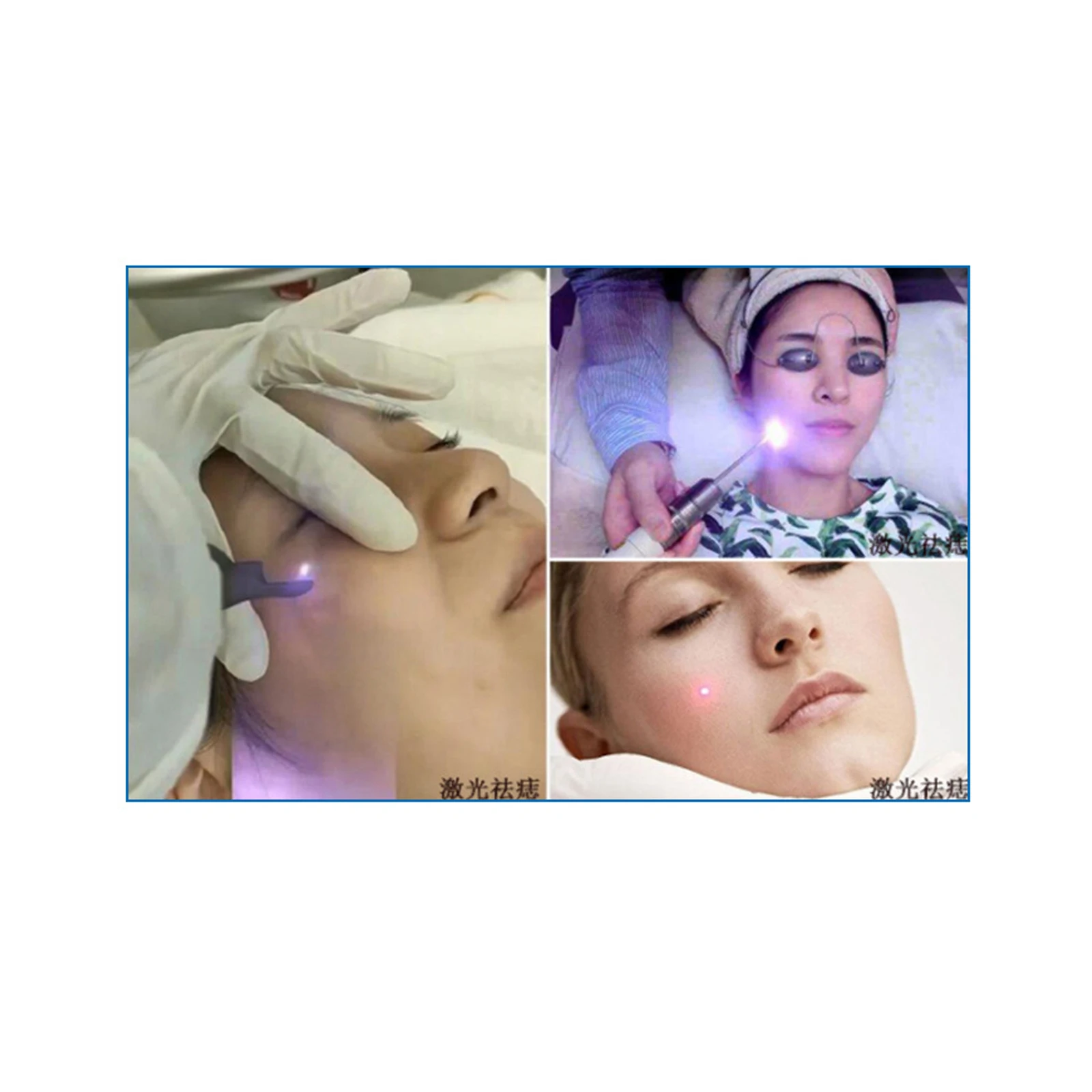 1W 850nm Beauty Laser Head for Moles Removal Skin Care