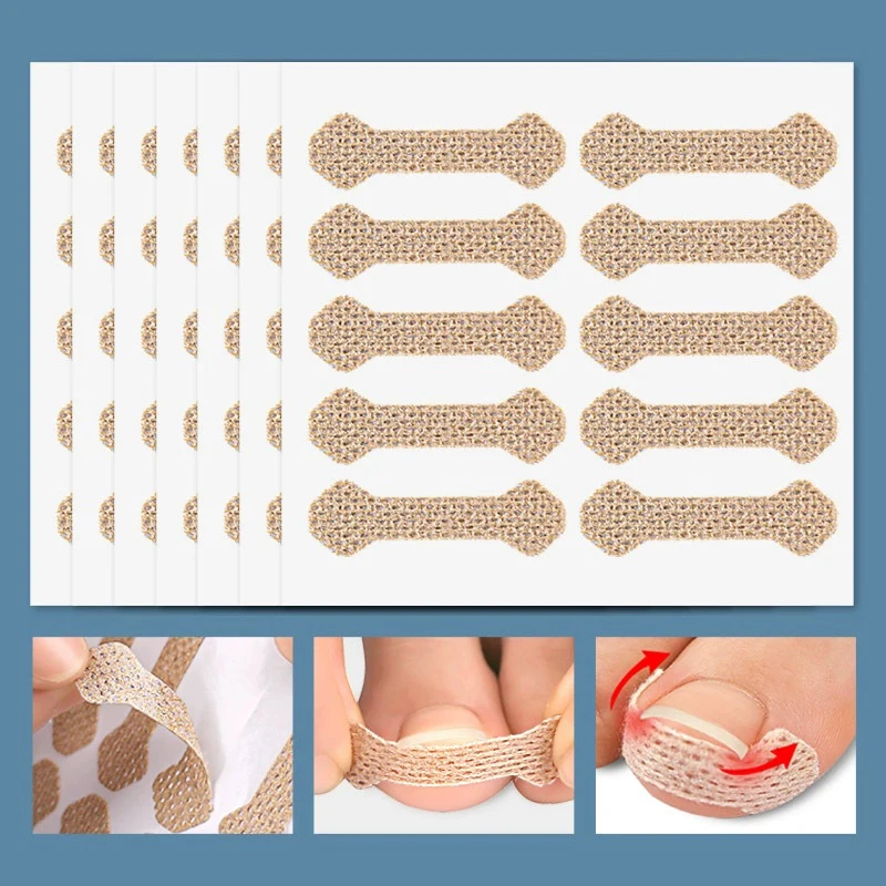 

60pcs Ingrown Paronychia Toenail Corrector Strips Anti Nail Patch Feet Sleeping Nail Patch Nails Into The Flesh Long Toe Pad