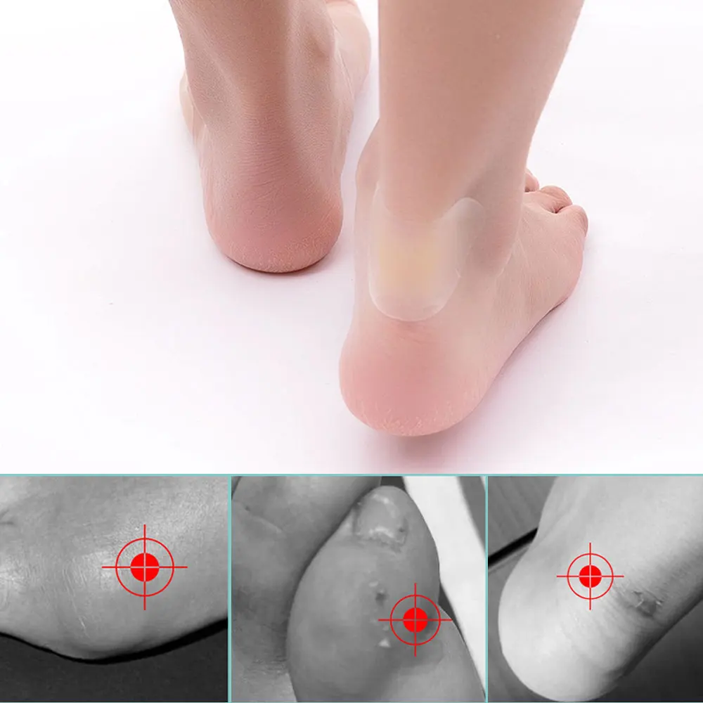 10 قطعة ملصقات أحذية هلام منصات الغروانية المائية الناعمة الإغاثة الألم بثور الأورام الذرة النسيج الاحتكاك ضغط كعب الألم التصحيح