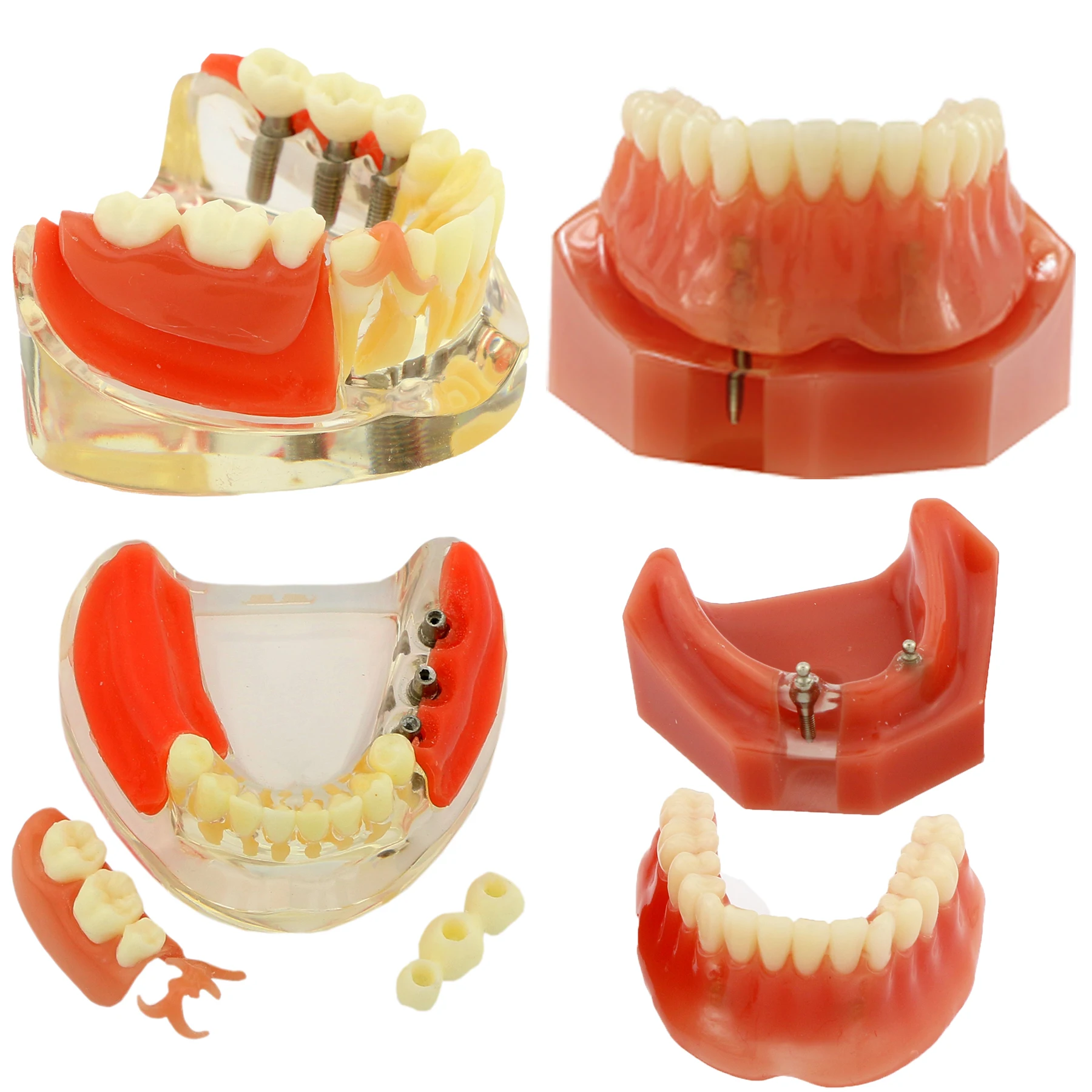 SEUJJRO wielofunkcyjne typy Model dentystyczny wymienny implant zębów nauczanie ortodontyczne Studing Demo dla dentysty uczeń szkoła