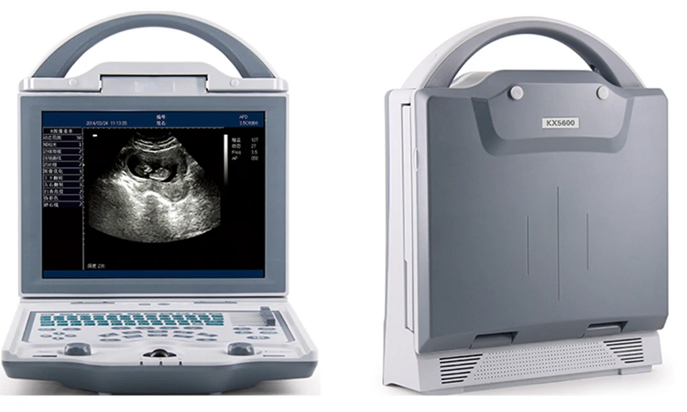 KX5600 VET Veterinary Ultrasound Scanner Diagnosed Instrument Pet Hospital Clinic