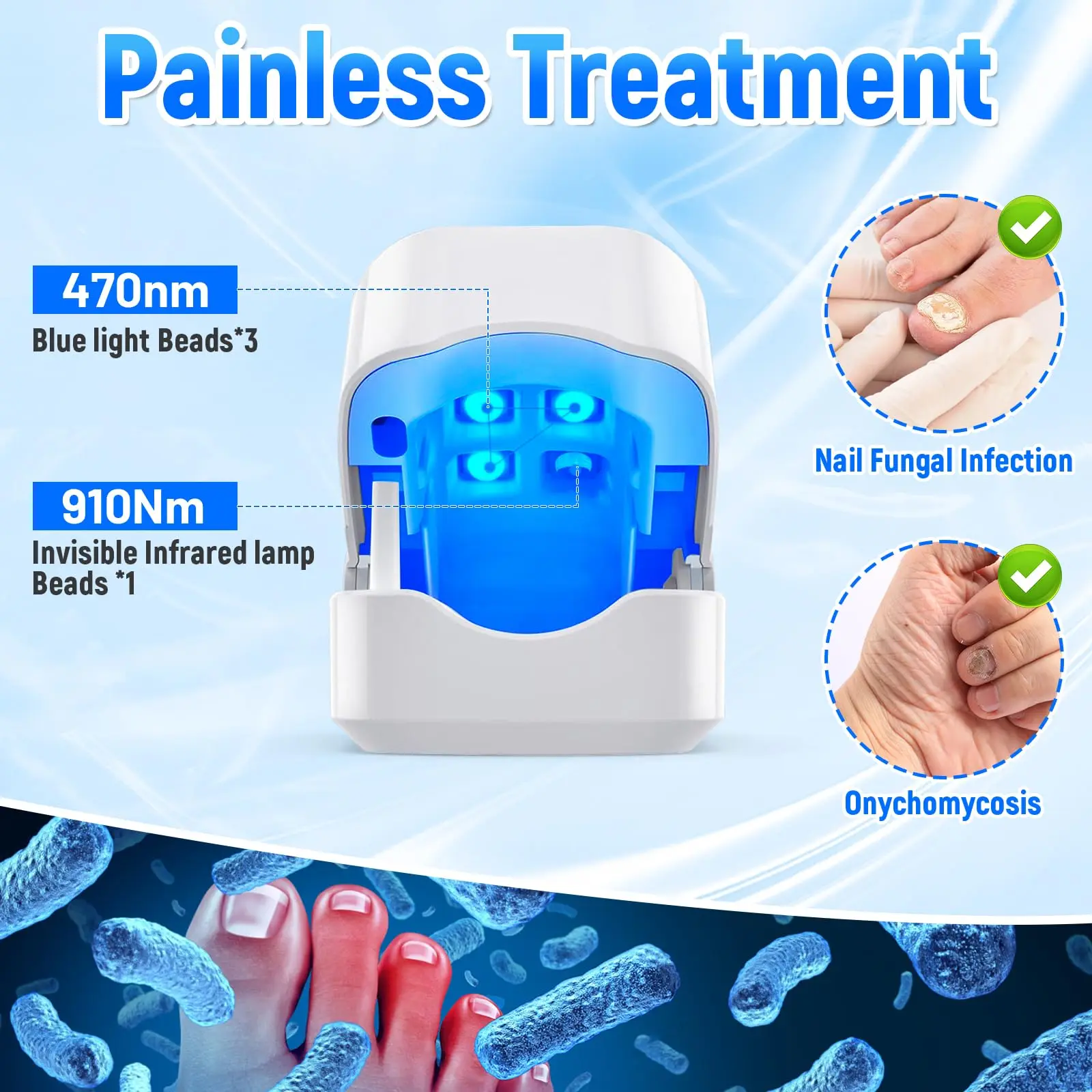 Repair Fast Nail Fungus Onychomycosis Fungus Nail Laser Device Fungus Cleaning Laser Device Remove Nail Fungus Cure Ingrown Tool