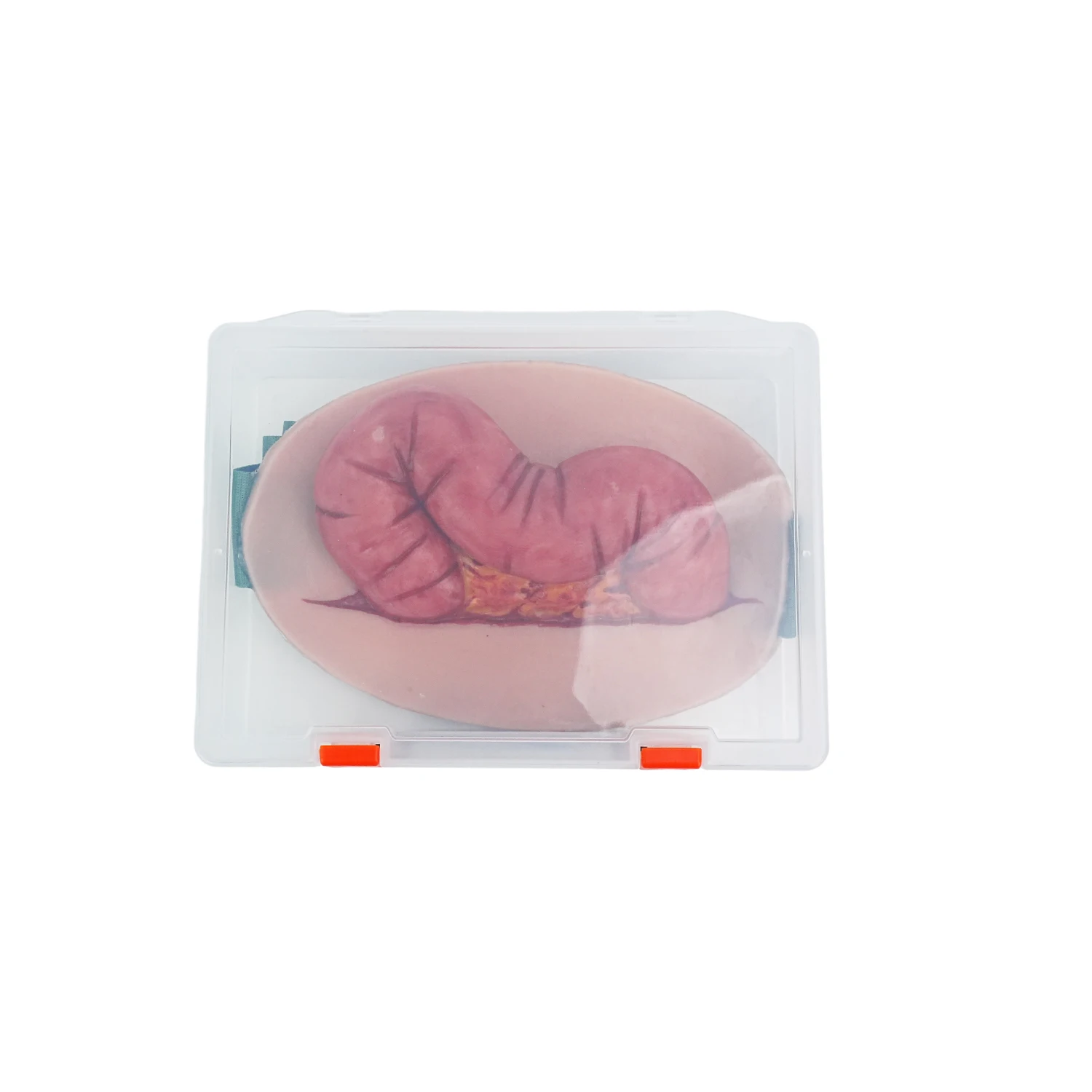 Wearable Abdominal Evisceration with Colon Wound Simulator