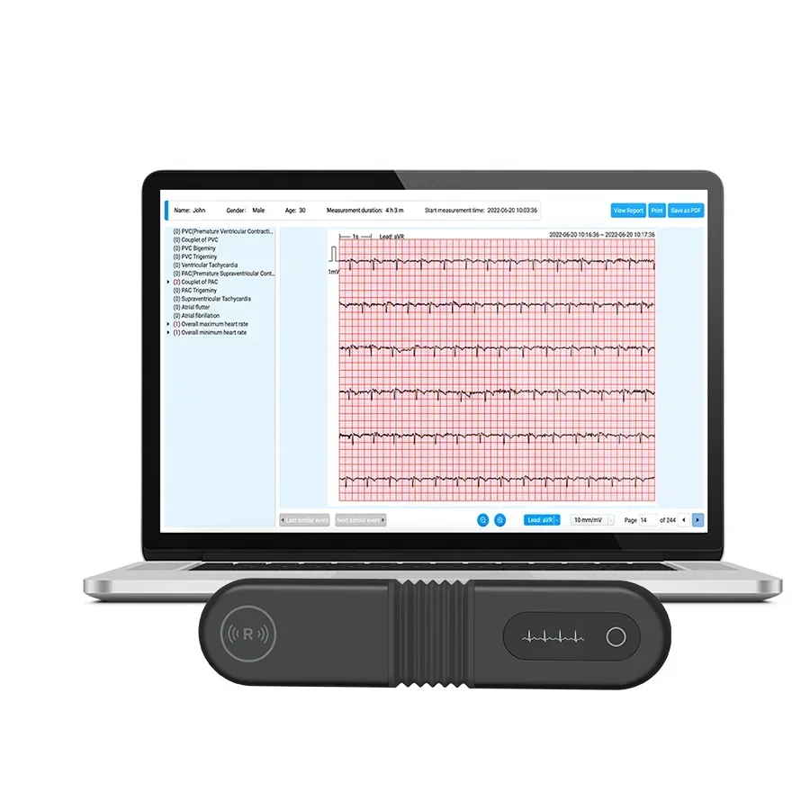 AI-ECG-Analysesoftware Tragbarer Bluetooth-ECG-Recorder 24/72 Stunden dynamischer Echtzeit-ECG-Monitor mit APP