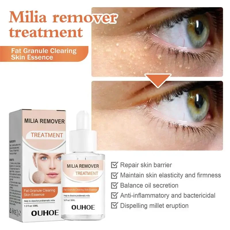 Fat Granules Removal Eye Serum Anti Dark Circle Eye Bags Fade Fine Line Essence Anti-Puffiness Moisturizing Skin Care Products